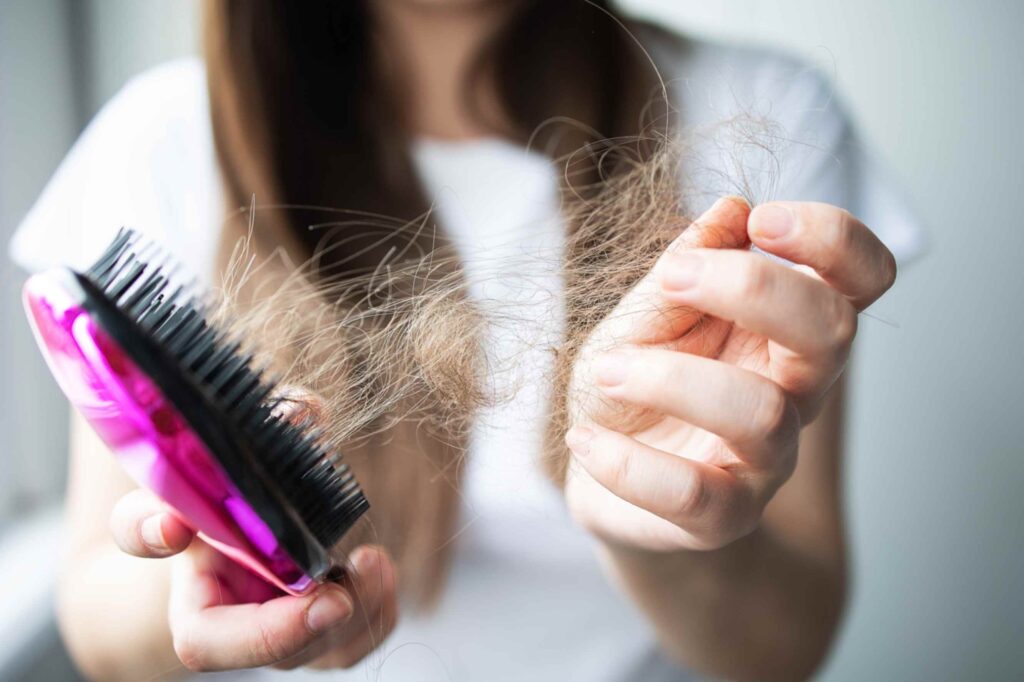 hair loss
