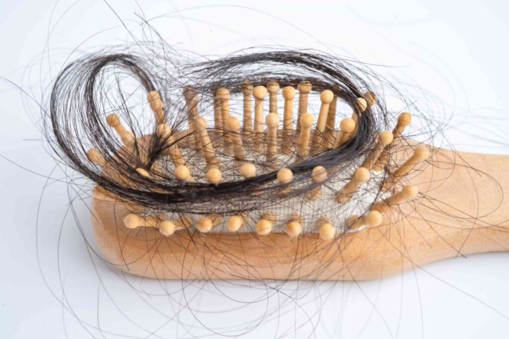 hair loss